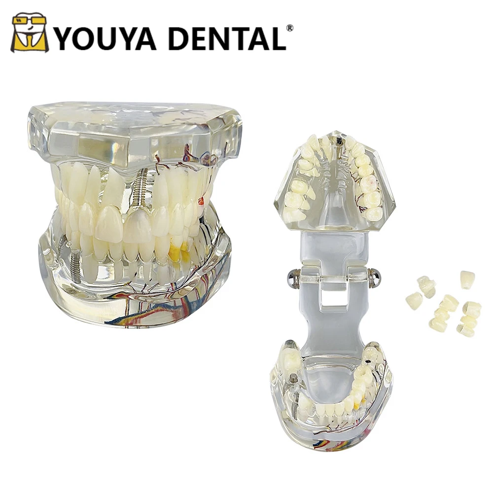 Модель восстановления нервной системы в детском возрасте, патологическая модель молочного постоянного зуба с кариесом, практика обучения студентов-стоматологов